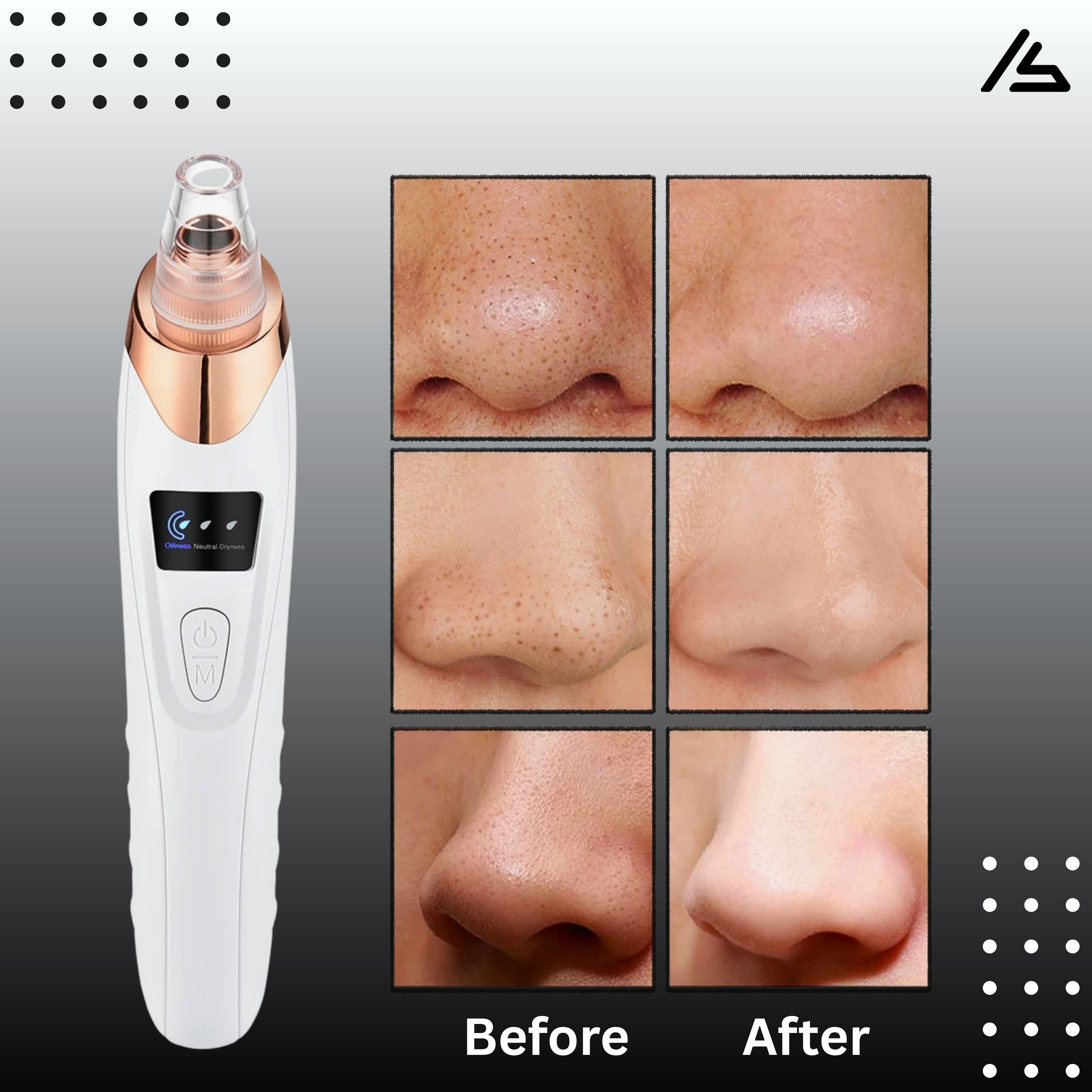 Electric Blackhead Remover Vacuum Acne Cleaner – 5 in 1 Facial Pore Cleaner Machine, Black Spots Removal Device, Derma Suction Pimple Acne Remover, Whitehead Extractor & Exfoliating Skin Care Beauty Tool with 5 Heads Suction